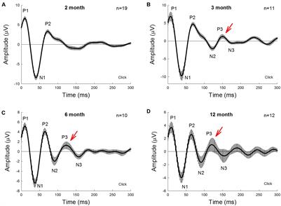 Early Functional and Cognitive Declines Measured by Auditory-Evoked Cortical Potentials in Mice With Alzheimer’s Disease